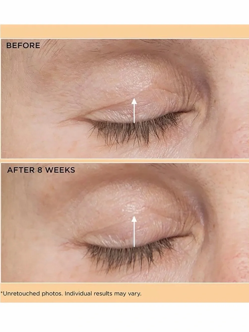 NIB Perricone MD Eyelid Lift Serum with Acyl-Glutathione and a Vitamin F blend.